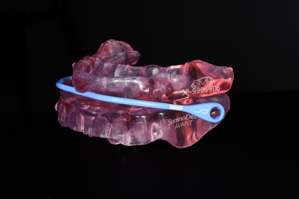 A mandibular advancement splint for the correction of sleep apnoea